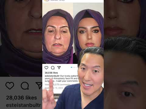 Turkish Plastic Surgeon’s Results- REAL or SUS?