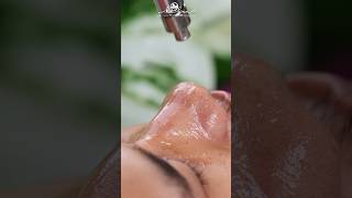 Blackheads and White Heads Removal #shorts #trending #viralreels #youtube #tamil #skincare 🥰😇👃