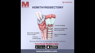 Our complete revivew of Hemithyroidectomy-Meddco