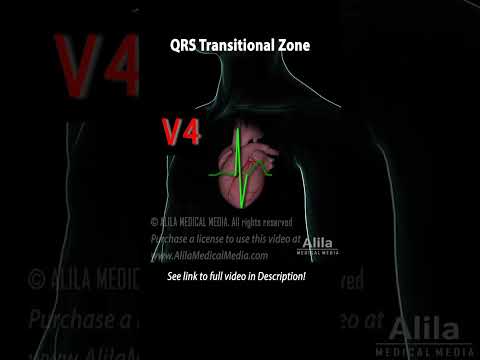 QRS Transitional Zone and R-Wave Progression #medicalanimation #ekg #ecg #3danimation #cardiology