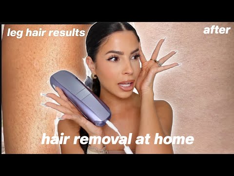 I TRIED LASER HAIR REMOVAL AT HOME... this is what happened...