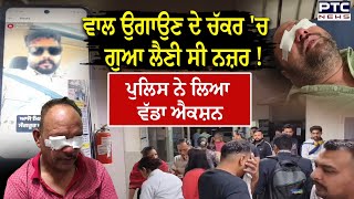 Sangrur Free Camp : ਗੰਜੇਪਨ ਤੋਂ ਛੁਟਕਾਰਾ ਪਾਉਣ ਦੇ ਚੱਕਰ 'ਚ ਹੋ ਚੱਲੇ ਸੀ 'ਅੰਨ੍ਹੇ' ! ਮੁਫ਼ਤ ਕੈਂਪ ਪਿਆ ਭਾਰੀ