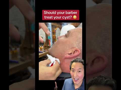 Should Your Barber Treat Your Cyst?