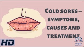 Cold Sores – Symptoms, Causes and Treatment