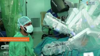 What Is Robotic Surgery: A Minimally Invasive Surgery | Max Hospital