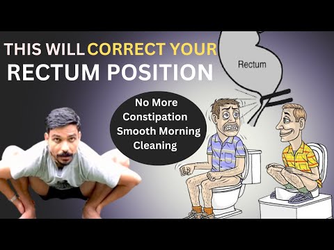 CORRECT YOUR RECTUM POSITION | NO MORE CONSTIPATION | YOGA FOR CONSTIPATION | ​⁠@PrashantjYoga