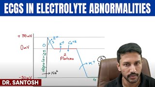 ECGs in Electrolyte Abnormalities | Medicine | Master ECG Series with Dr. Santosh | PW MedEd