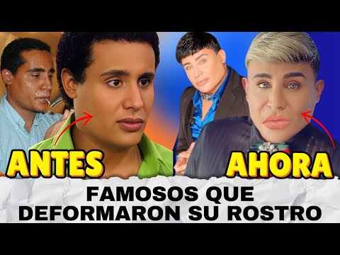 Famosos que ESTAN IRRECONOCIBLES por su cambio de rostro