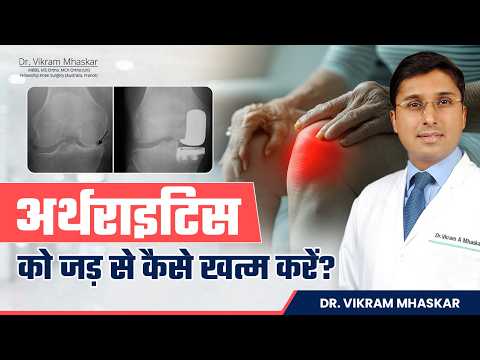 घुटनो का घिसना | Osteoarthritis से छुटकारा कैसे पाएं? | Osteoarthritis के Best Treatment