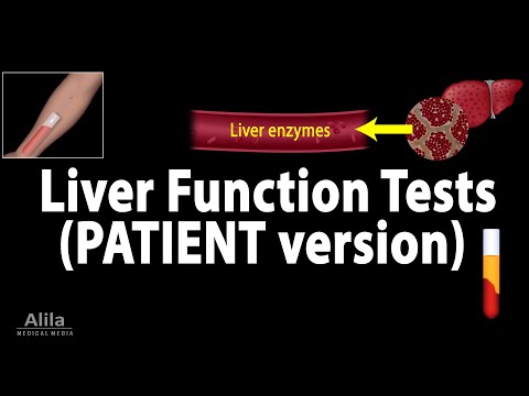 Liver Function Tests, Animation for Patients