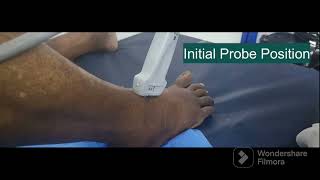 Ankle joint Injection ultrasound @painclinic-Mayiladuthurai