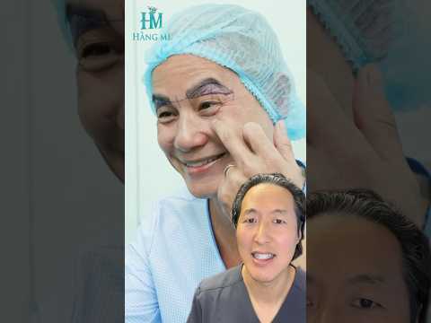 Reacting to Extreme Asian Plastic Surgery!