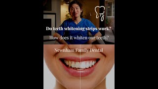 Do teeth whitening strips work?