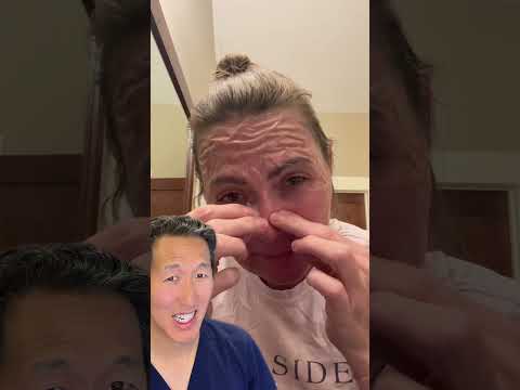 Plastic Surgeon Reacts to DIY Gelatin Face Mask!