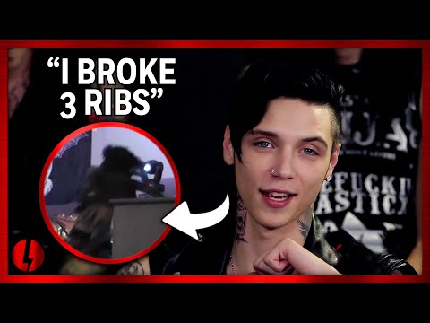 Rockers' Worst Onstage Injury Stories