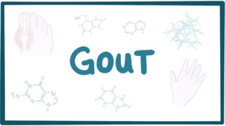 Gout - causes, symptoms, diagnosis, treatment, pathology