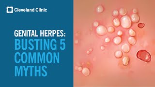 Busting 5 Myths About Genital Herpes