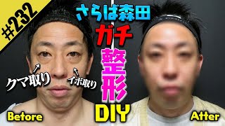 [Goodbye Morita, serious DIY plastic surgery] Big transformation with dark circles and warts remo...