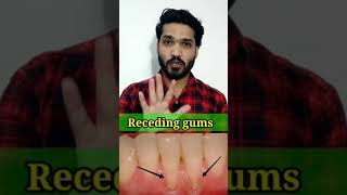 नीचे जा रहे मसूड़ो का घरेलू इलाज | Gum recession home remedies | easy dentistry #shorts