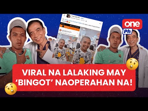 Viral na lalaking nagpa-edit para matanggal ang kanyang ‘bingot,’ naoperahan na! | One PH Shorts