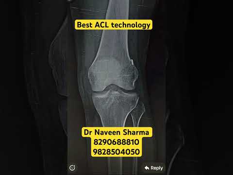 For appointment with Dr Naveen sharma contact 8290688810 and 9828504050