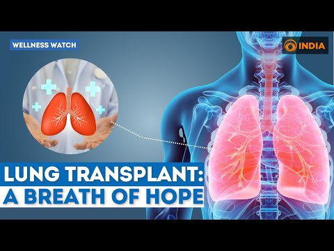 Lung transplant: A breath of hope