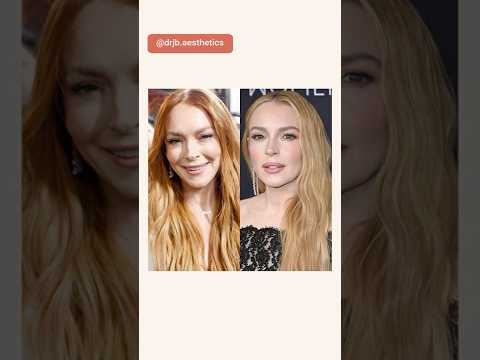 Have celebrities like Lindsay Lohan & Christina Aguilera had facelifts?