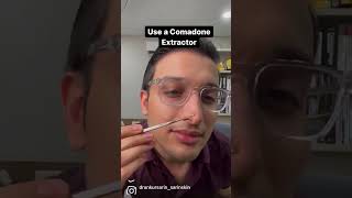 HOW TO REMOVE BLACKHEADS AT HOME | DR. ANKUR SARIN | SARIN SKIN SOLUTIONS |