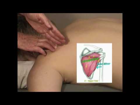 Infraspinatus massage and trigger point release.