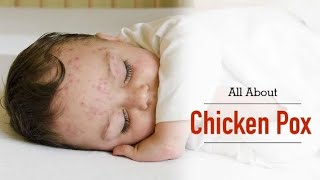 Ayurveda treatment 🎋 for Chickenpox 👶 scars #health #homeremedies #ayurveda #children