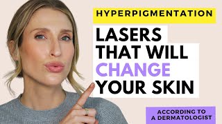 The Best Laser Treatments for Hyperpigmentation | Dr. Sam Ellis