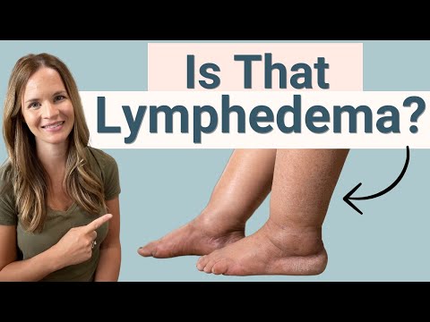 Lymphedema Signs and Symptoms